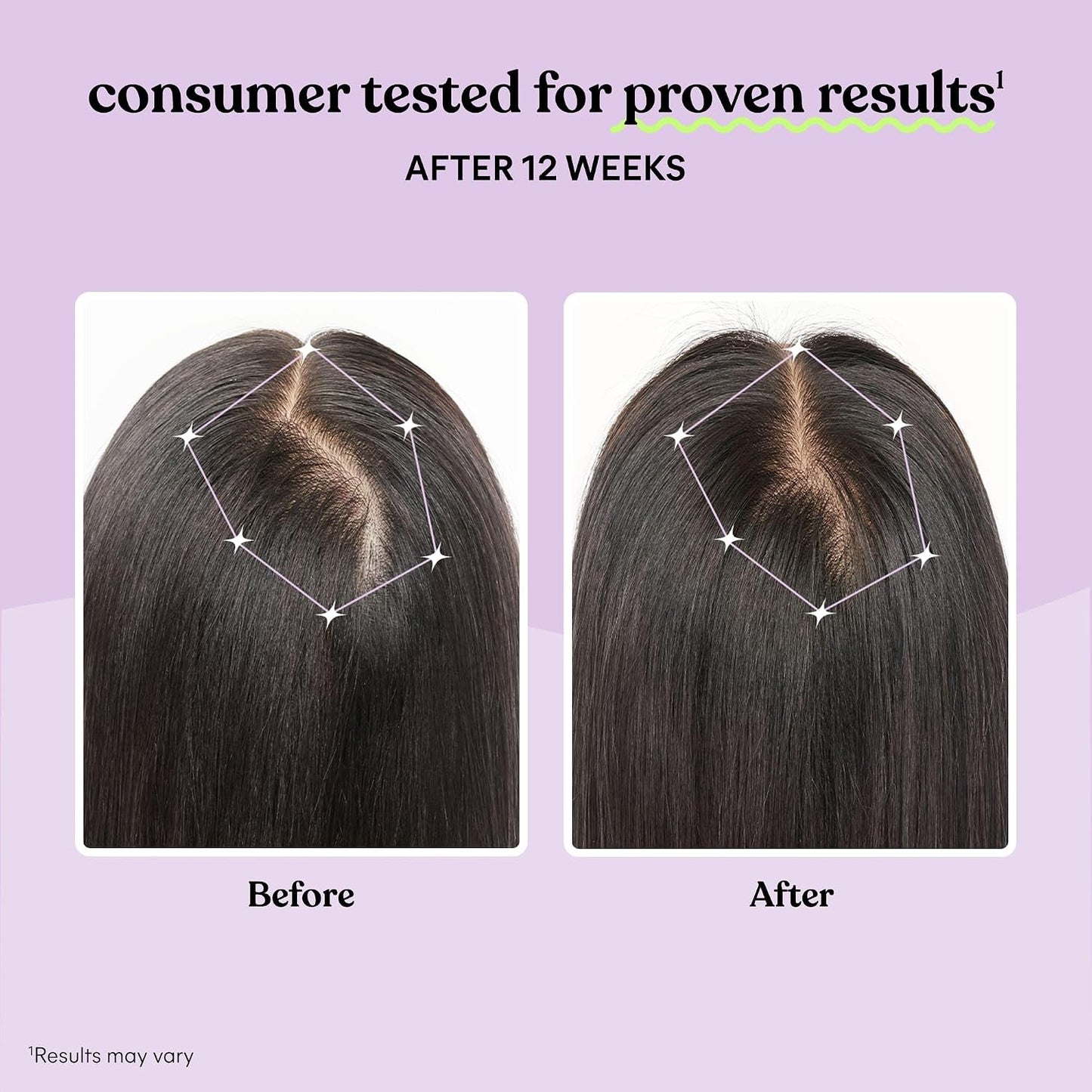 Suplemento para el Crecimiento del Cabello para Mujeres